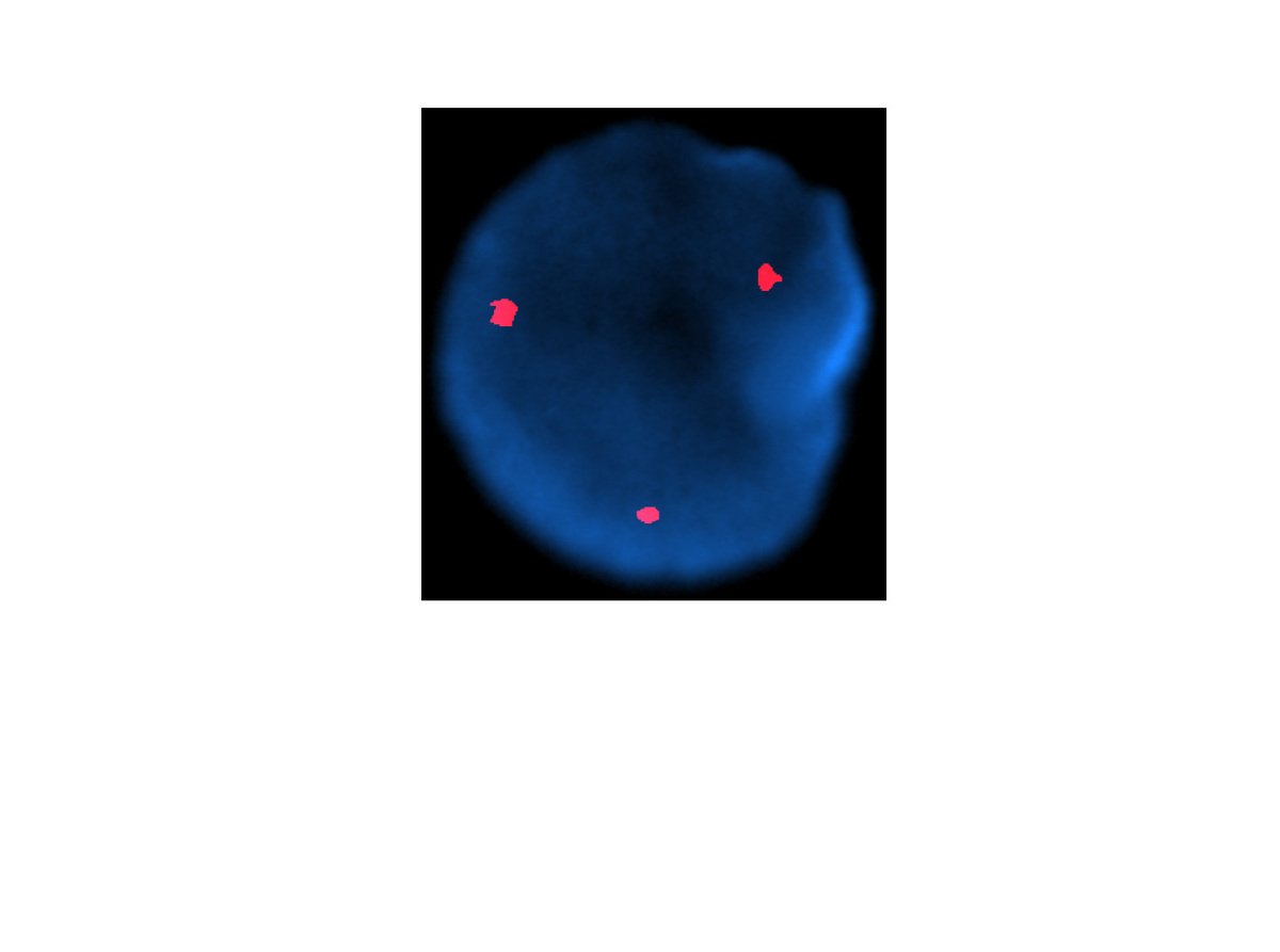 FISH, Trisomy 4